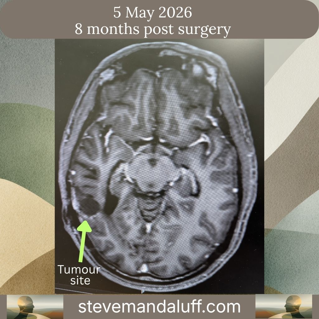 May 5 Brain Scan